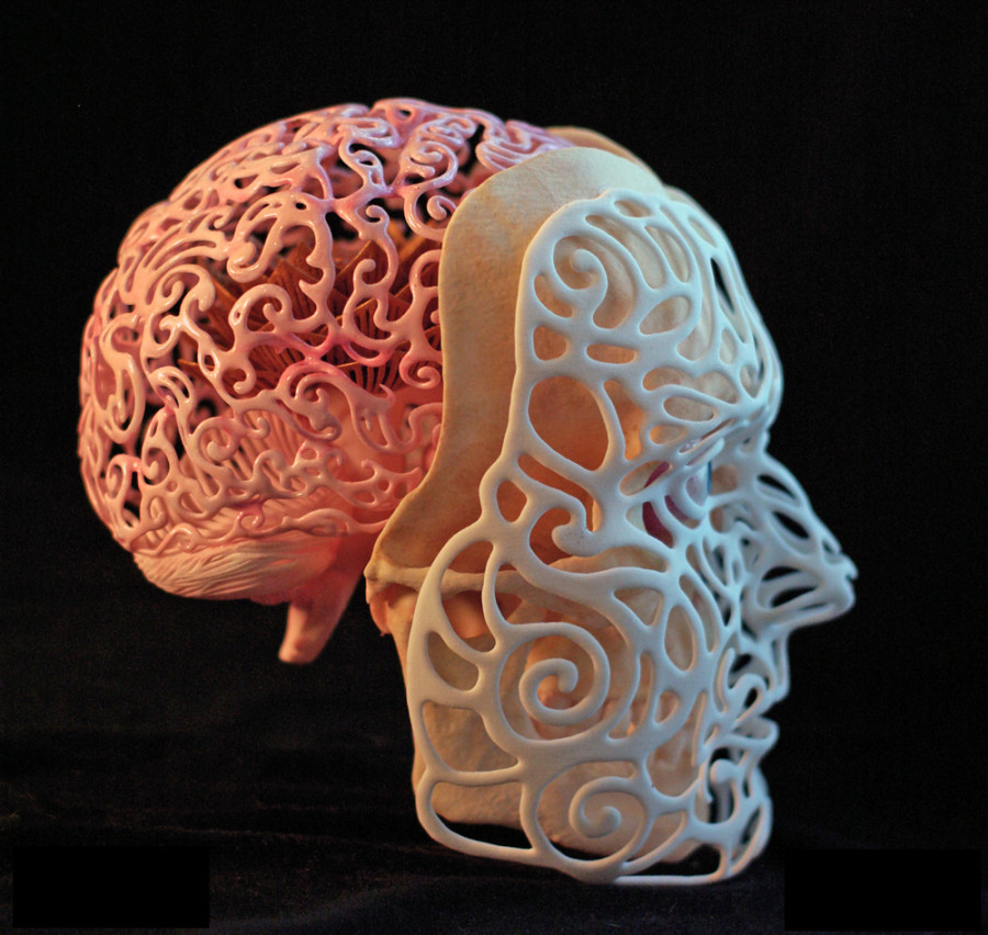 3D Printing in Spine Surgery- Cutting Edge BioTech