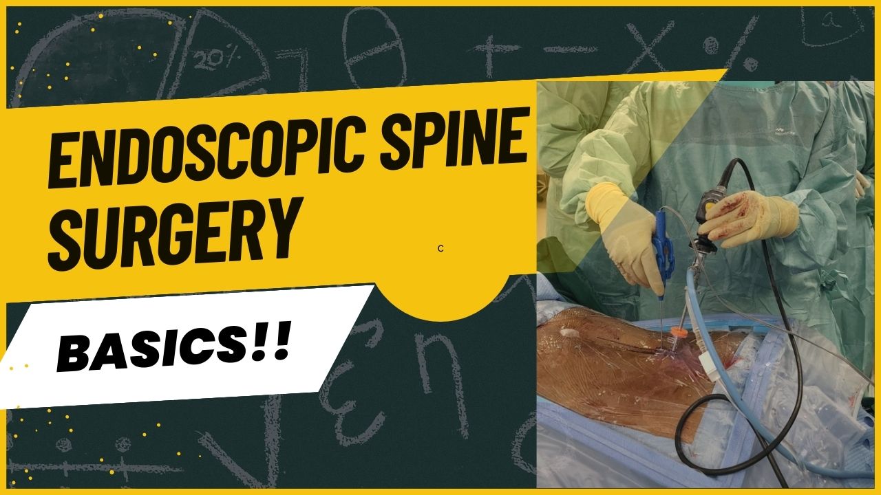 Endoscopic Spine Surgery-Basics!